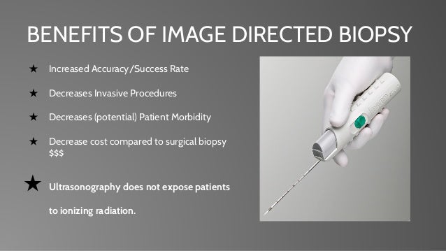 surgery mri guided breast biopsy Posing sexy video workout